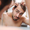 Going Bald Too Young? Top Tips From The Experts!