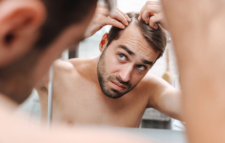 Going Bald Too Young? Top Tips From The Experts!