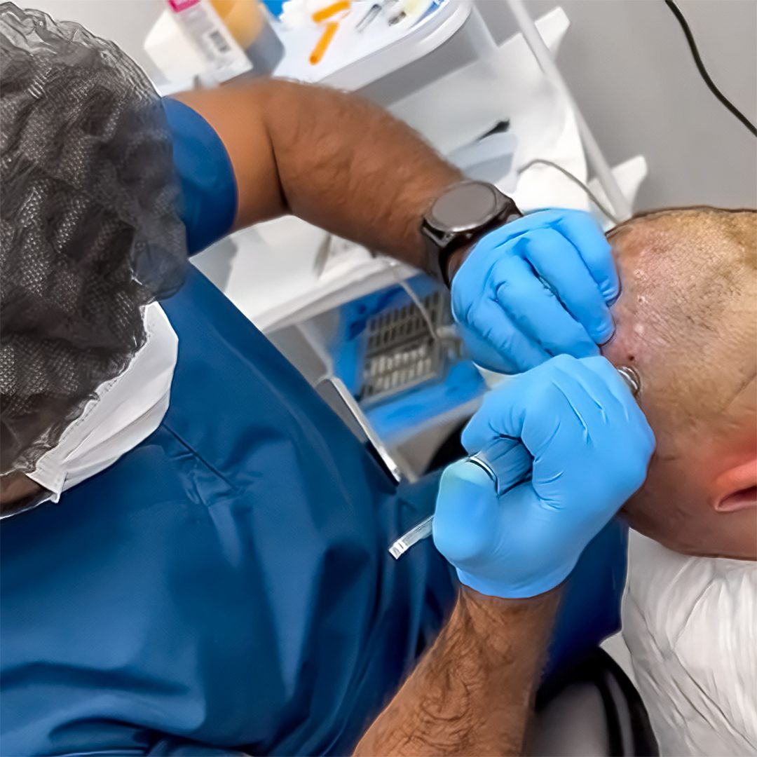 hair transplant surgeon